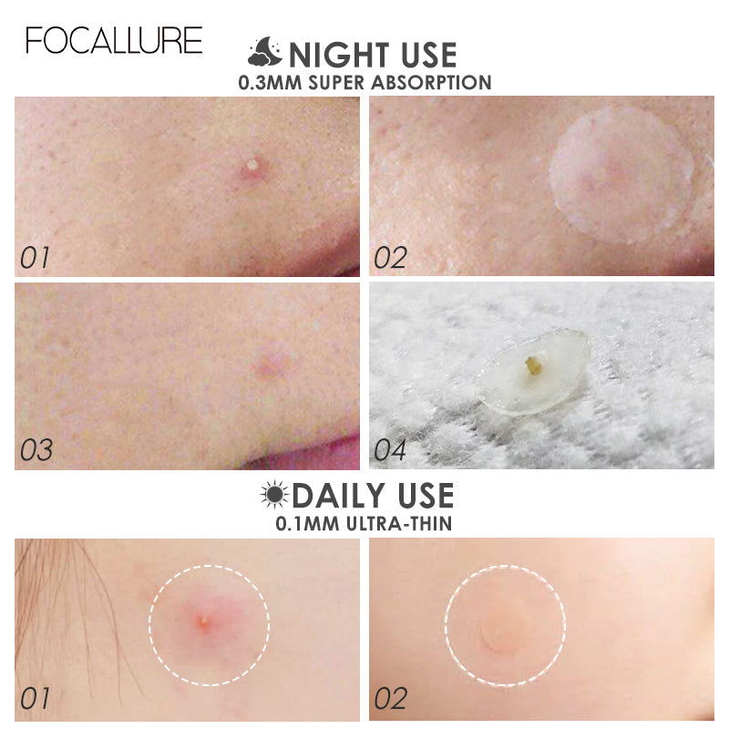 Focallure Acne Pimple Patch FA186 - 2