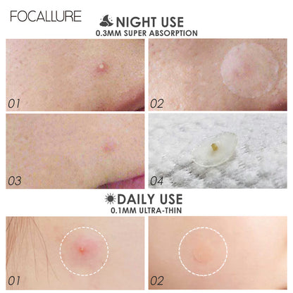 Focallure Acne Pimple Patch FA186 - 2