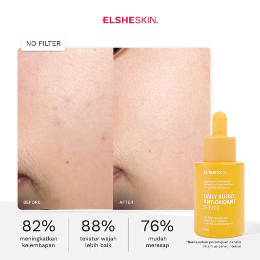 Elsheskin Daily Boost Antioxidant Serum 15ml