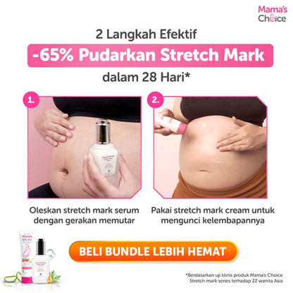 Mama's Choice Stretch Mark Serum 50ml