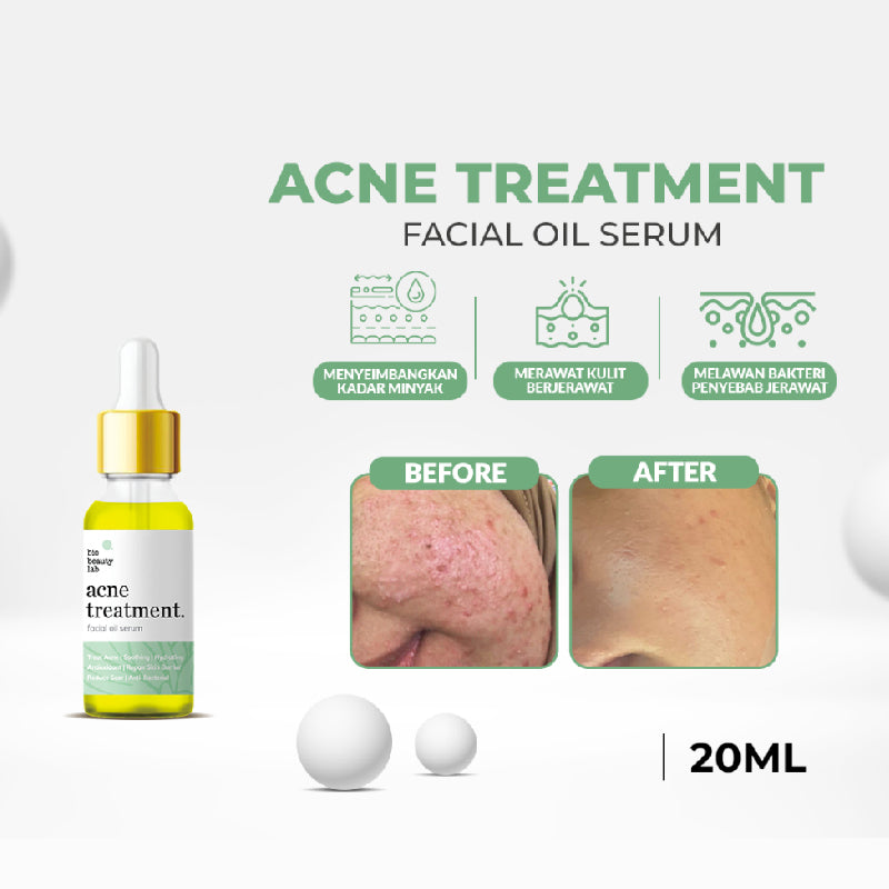 Bio Beauty Lab Acne Treatment Face Oil | 20 ml