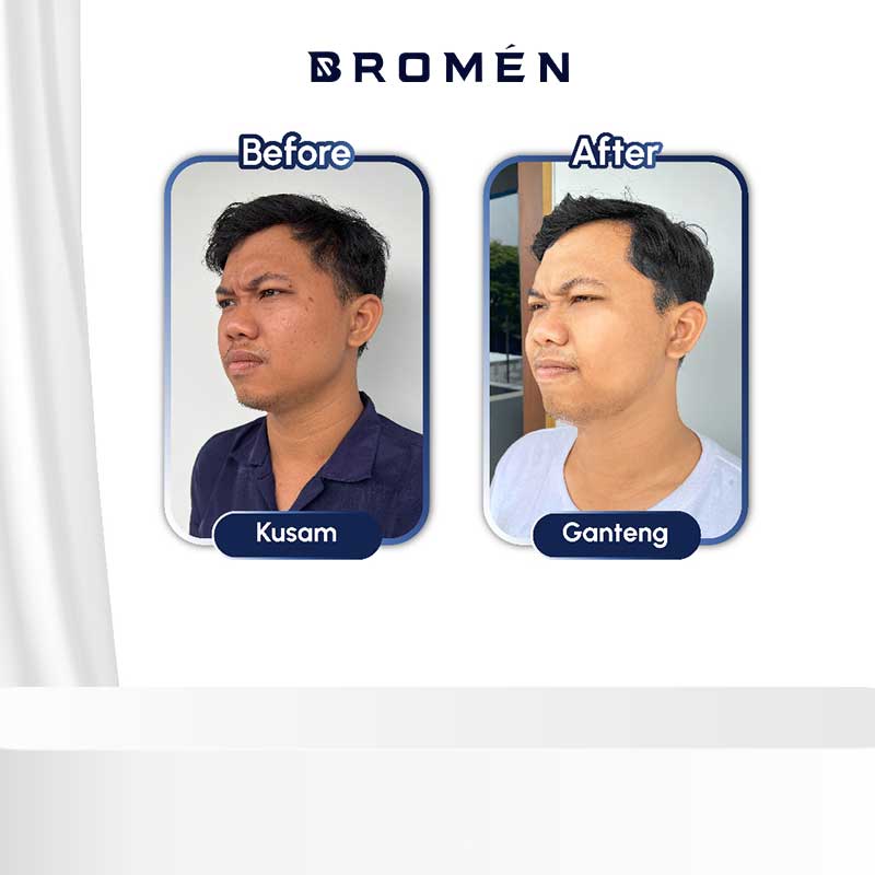 BROMEN Oil Control Facial Wash 100ml