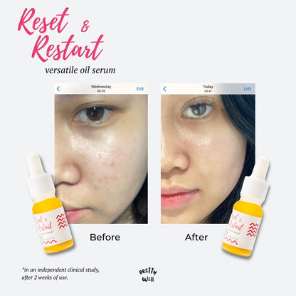 Prettywell Reset & Restart Versatile Oil Serum |10 ml