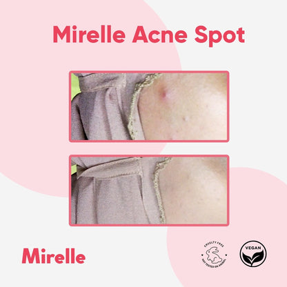 MIRELLE Acne Spot 20gr