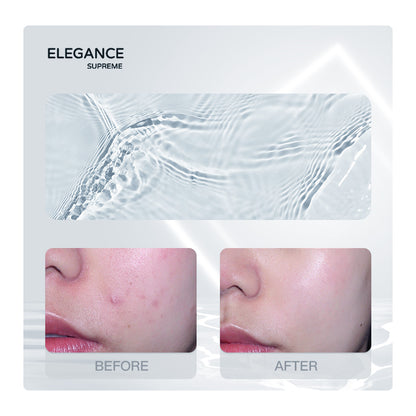 Elegance Supreme Nicotinamide Revitalizing Toner | 80ml