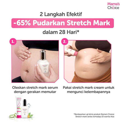 Mama's Choice Stretch Mark Cream 100ml