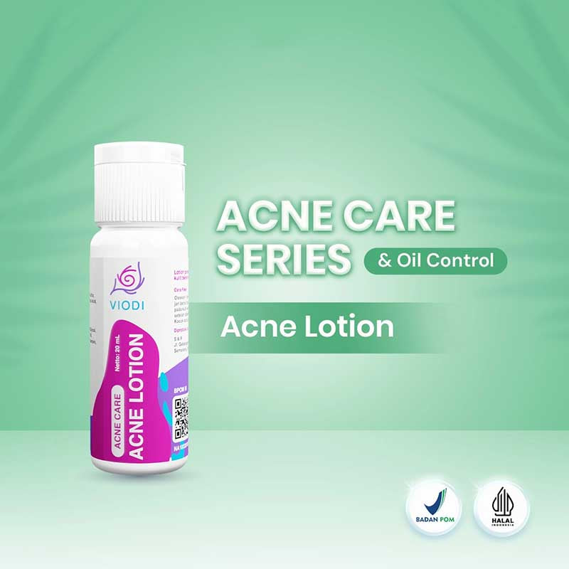 VIODI Acne Care - Acne Lotion 20 ml