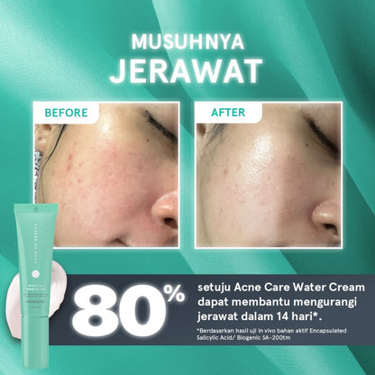 Dear Me Beauty Acne Series - Acne Care Water Cream