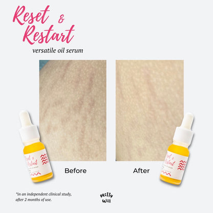 Prettywell Reset & Restart Versatile Oil Serum |10 ml