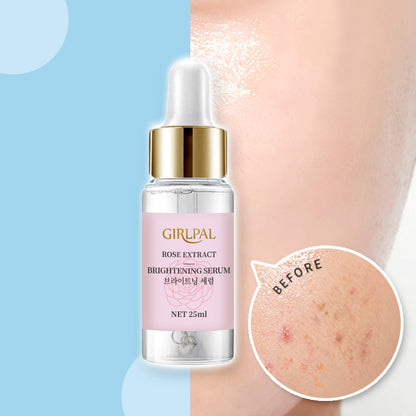 Girlpal Serum Niacinamide 4% Rose Brightening Essence | 25 ml