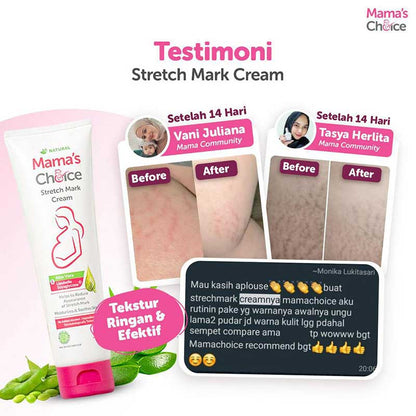 Mama's Choice Stretch Mark Cream 100ml