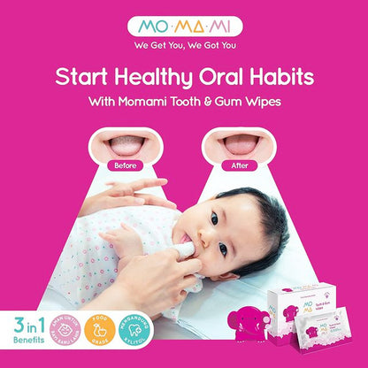 MoMaMi Baby Tooth & Gum - Tisu Basah Gigi & Gusi Bayi (20 Lembar)