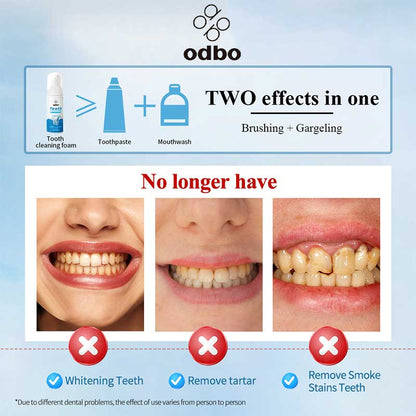 Odbo Tooth Cleaning Foam | 60ml