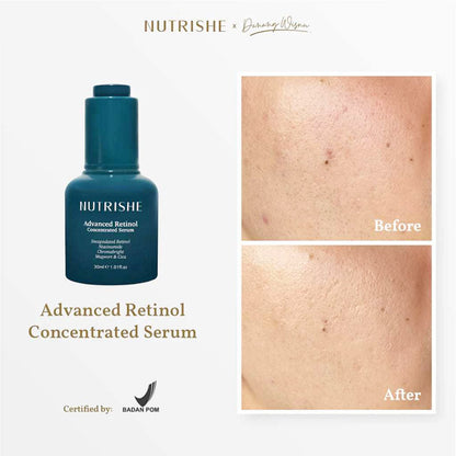 NUTRISHE Advanced Retinol Concentrated Serum X Danang Wisnu