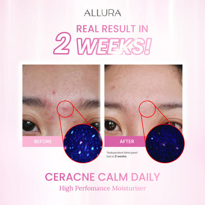 Allura Ceracne Calm Daily Moisturiser