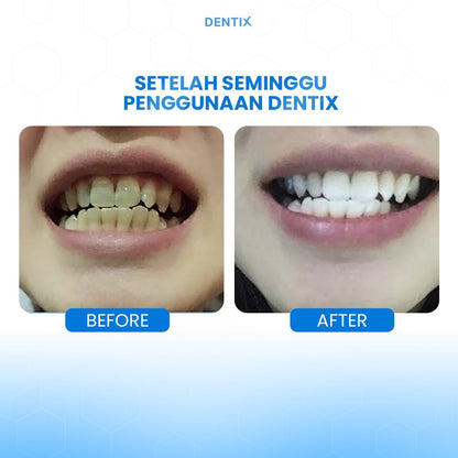 Dentix Teeth Whitening Expert | 20 gr