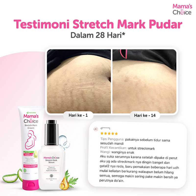 Mama's Choice Stretch Mark Serum 50ml